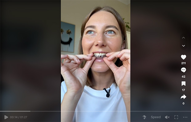TikTok dental UGC example
